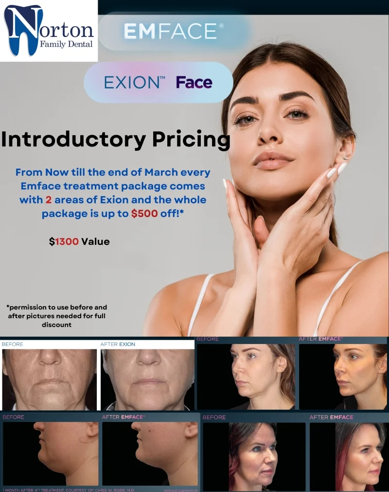 Exion Face Introductory Pricing until the end of march